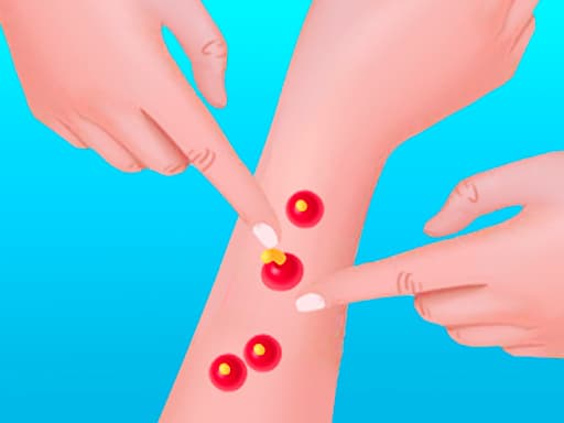 Pimple Poper Rush game screenshot - hypercasual - Free online game